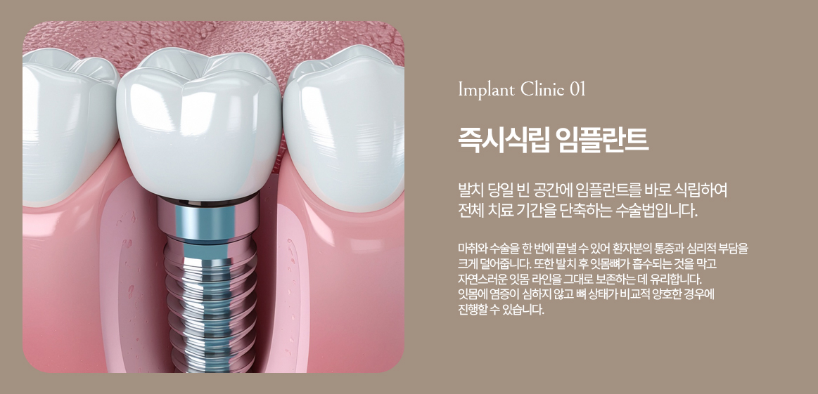 옥정온가족치과 즉시식립 임플란트 안내