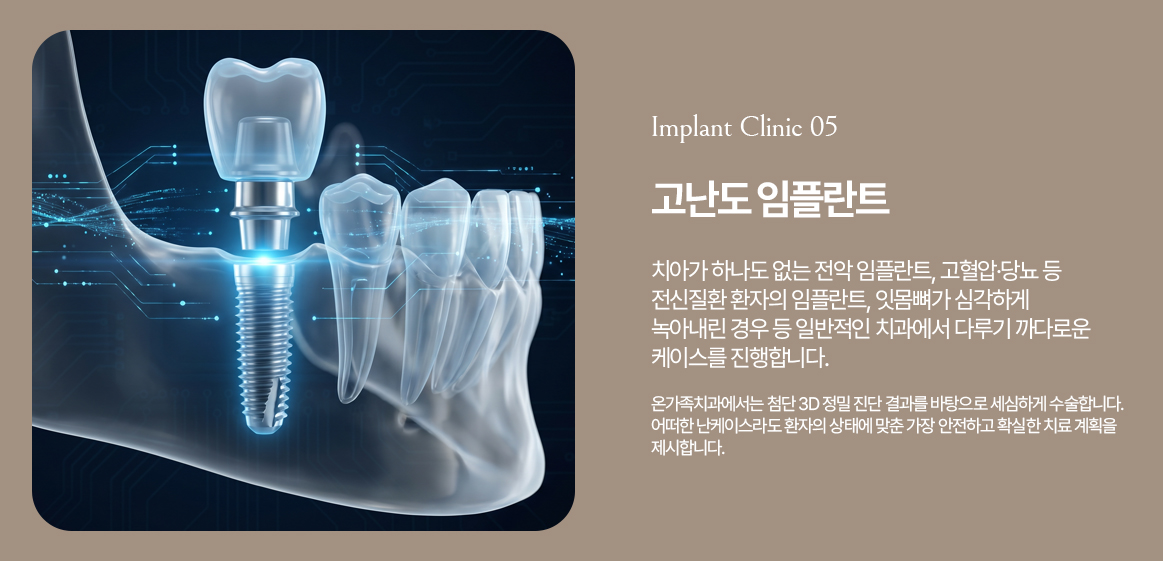 옥정온가족치과 고난도 임플란트 안내