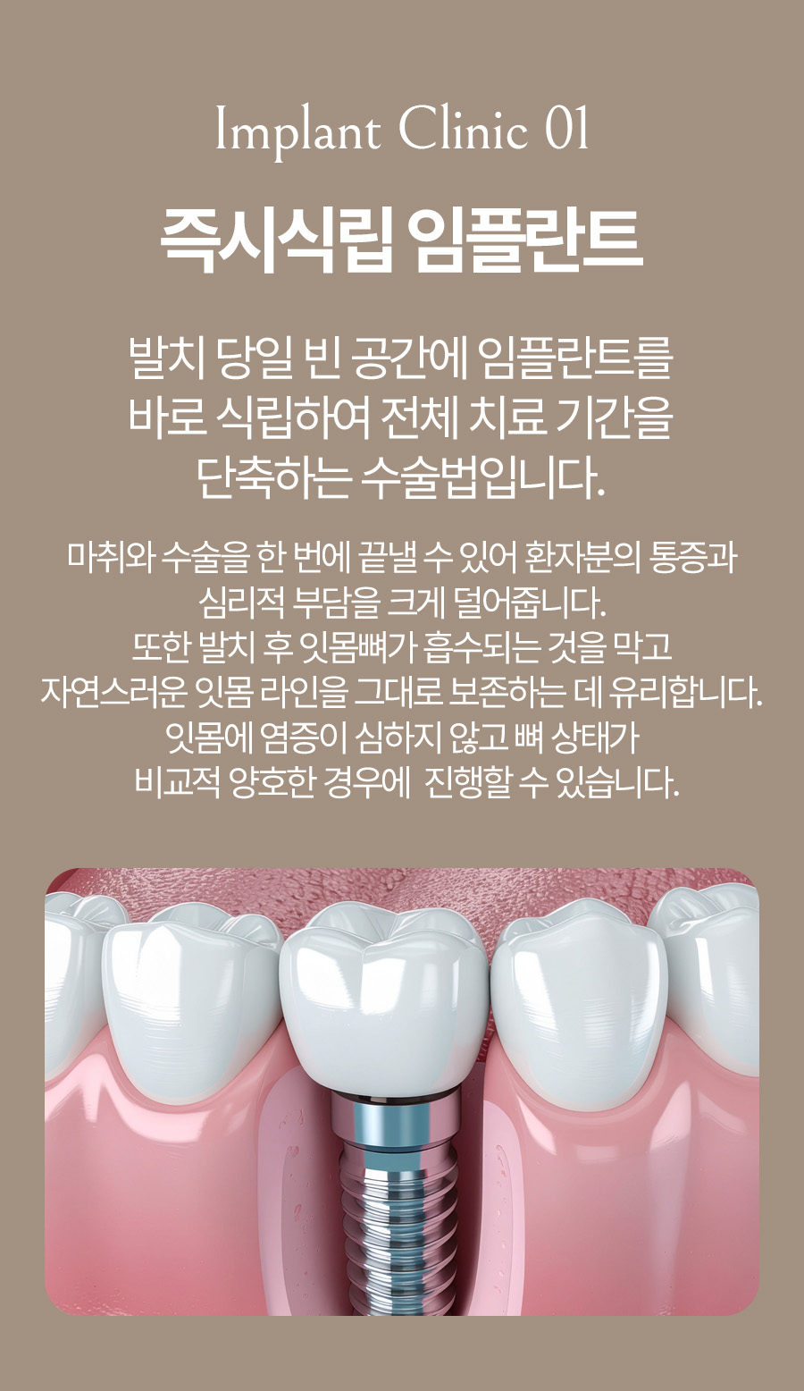 옥정온가족치과 즉시식립 임플란트 안내