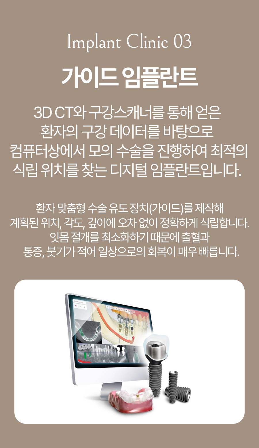 옥정온가족치과 가이드 임플란트 안내