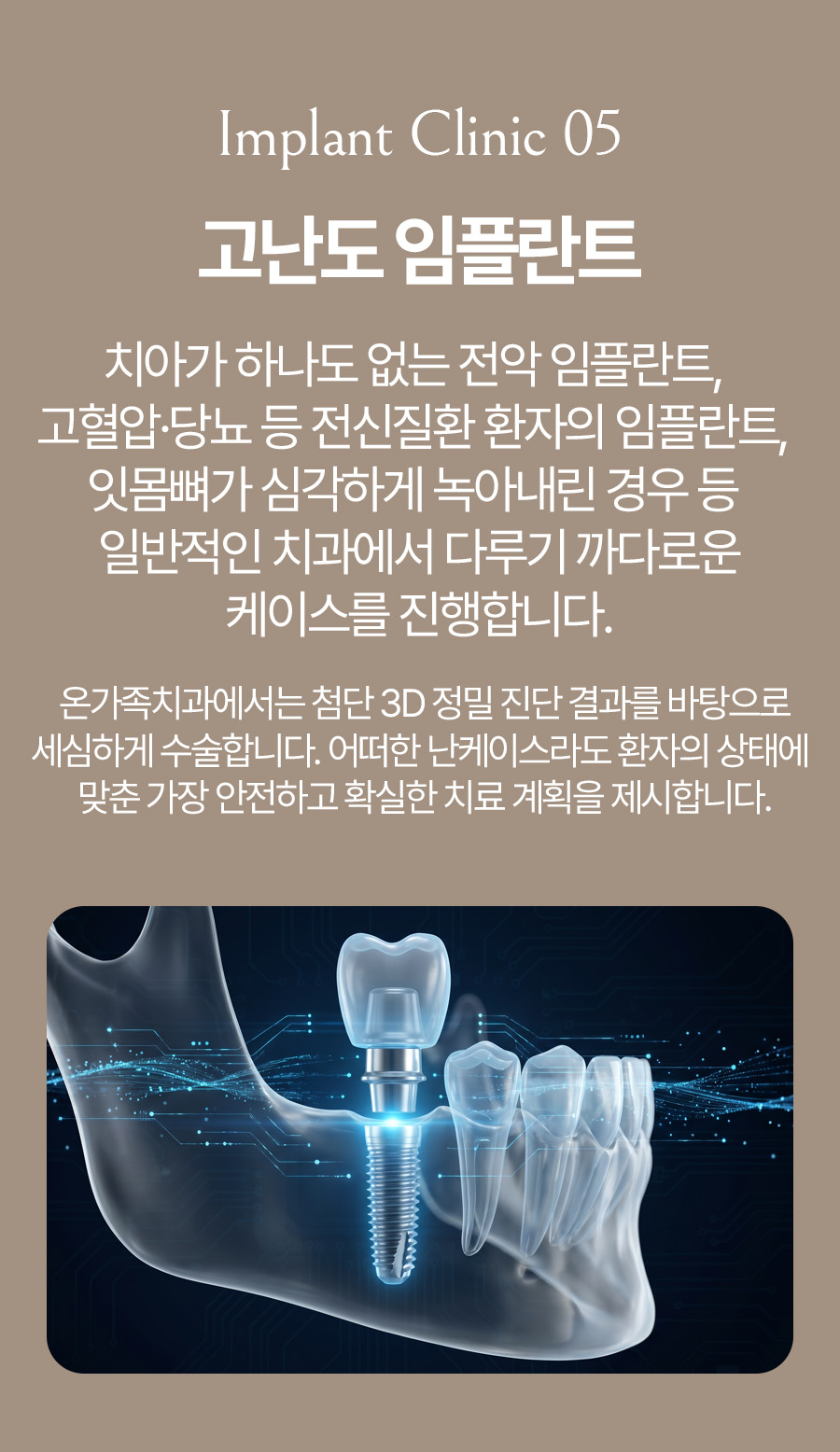 옥정온가족치과 고난도 임플란트 안내
